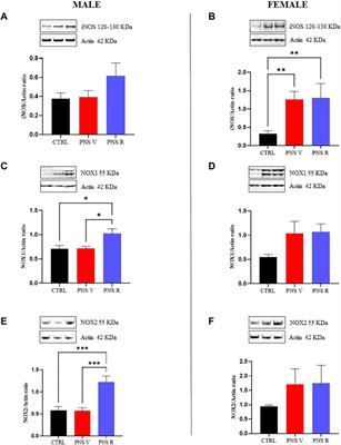 Prenatal stress induces a depressive-like phenotype in adolescent rats: The key role of TGF-β1 pathway